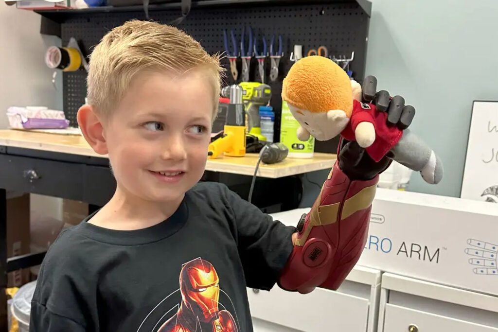 Boy with hero prosthetic arm