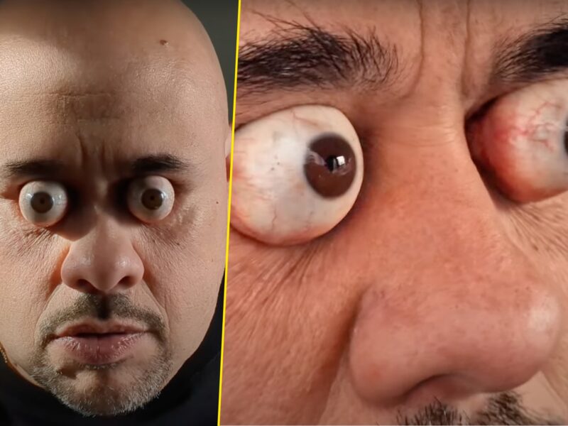 A Uruguay man has snagged a Guinness World Record for being able to pop his eye out of their sockets further than anyone else.